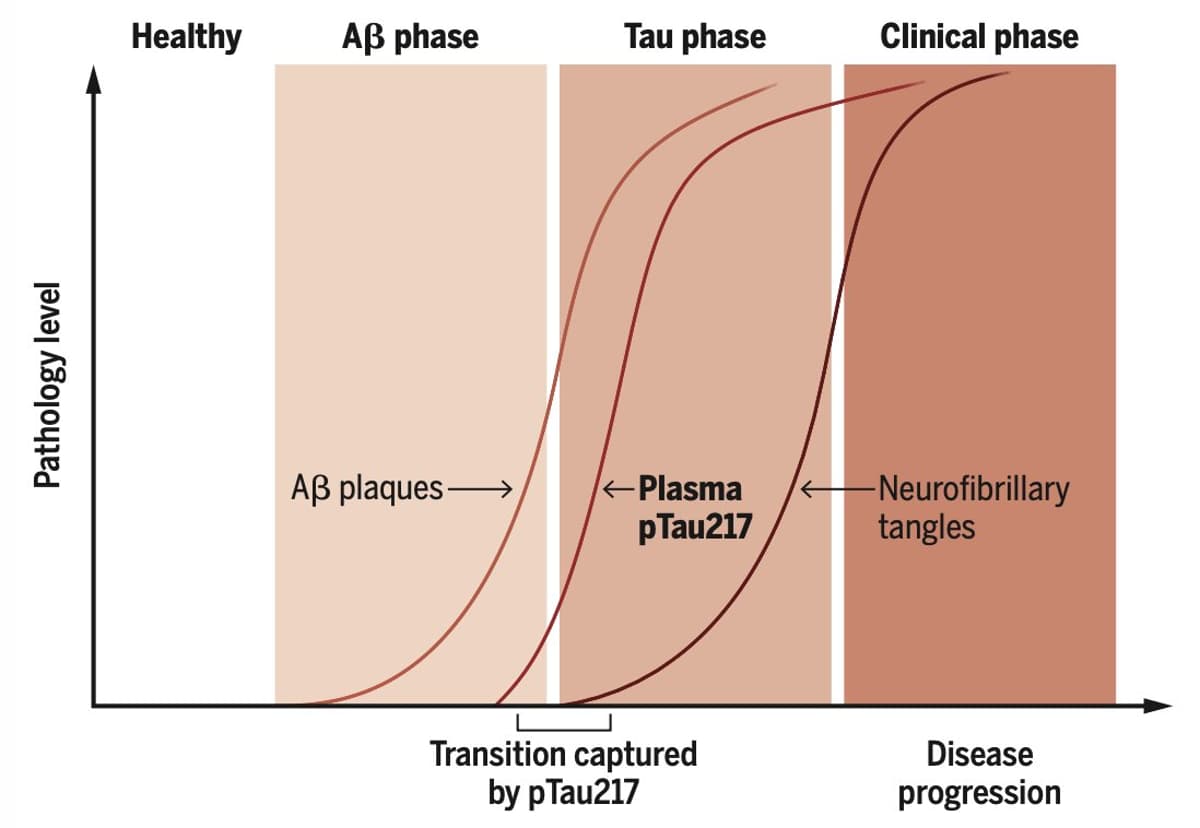 P‑tau217 Blood Test Predicts Alzheimer’s Risk Early