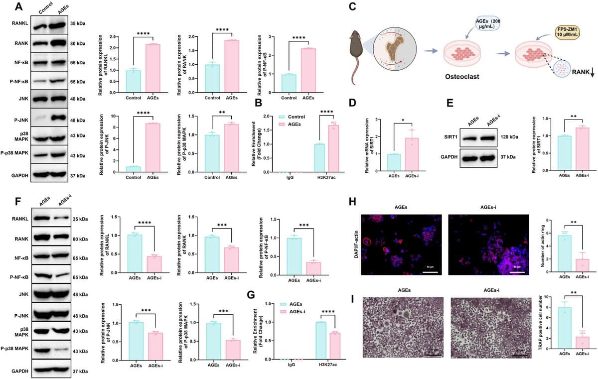 AGEs Trigger SIRT1 Loss, Accelerating Osteoarthritis via RANKL