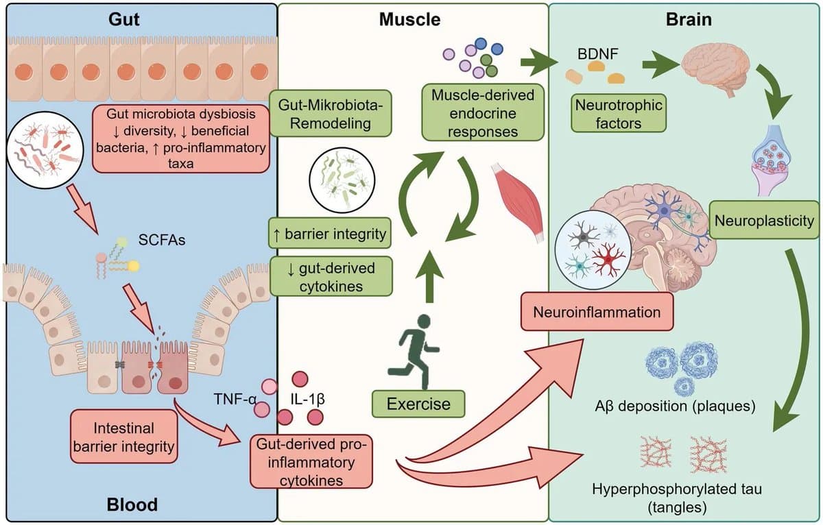 Exercise Reshapes Gut Microbiome to Protect Alzheimer’s Brain