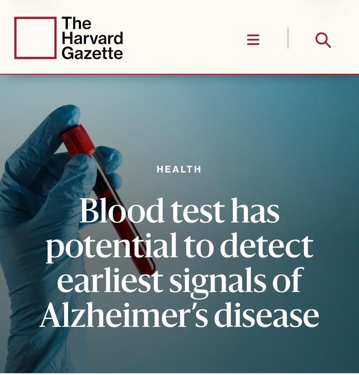 Blood Test May Forecast Alzheimer’s Years Before Symptoms