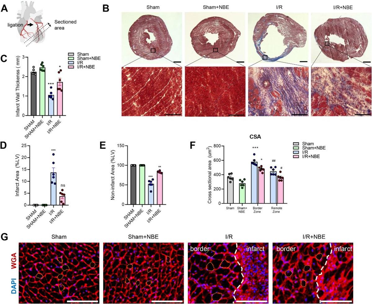 Plasma Dilution Boosts Cardiac Repair and Mobility in Aged Mice