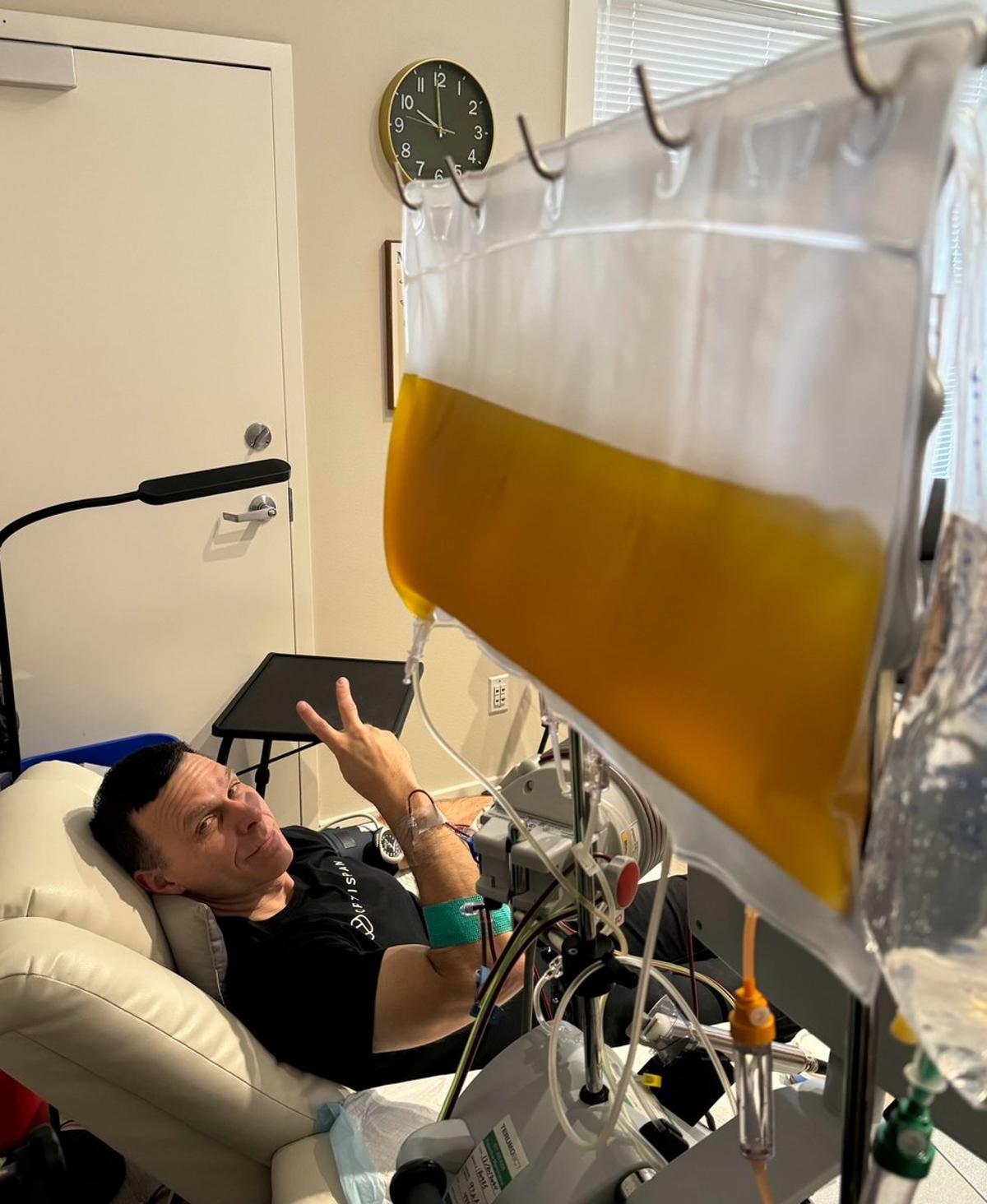 Therapeutic Plasma Exchange Cuts High Blood Microplastic Levels