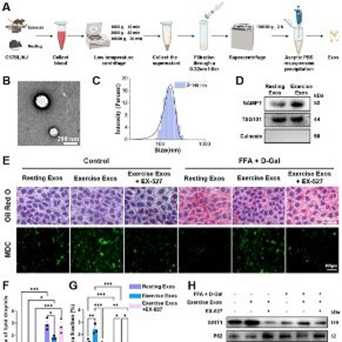 Exercise‑induced Exosomes Deliver NAMPT, Boost NAD, Protect Liver
