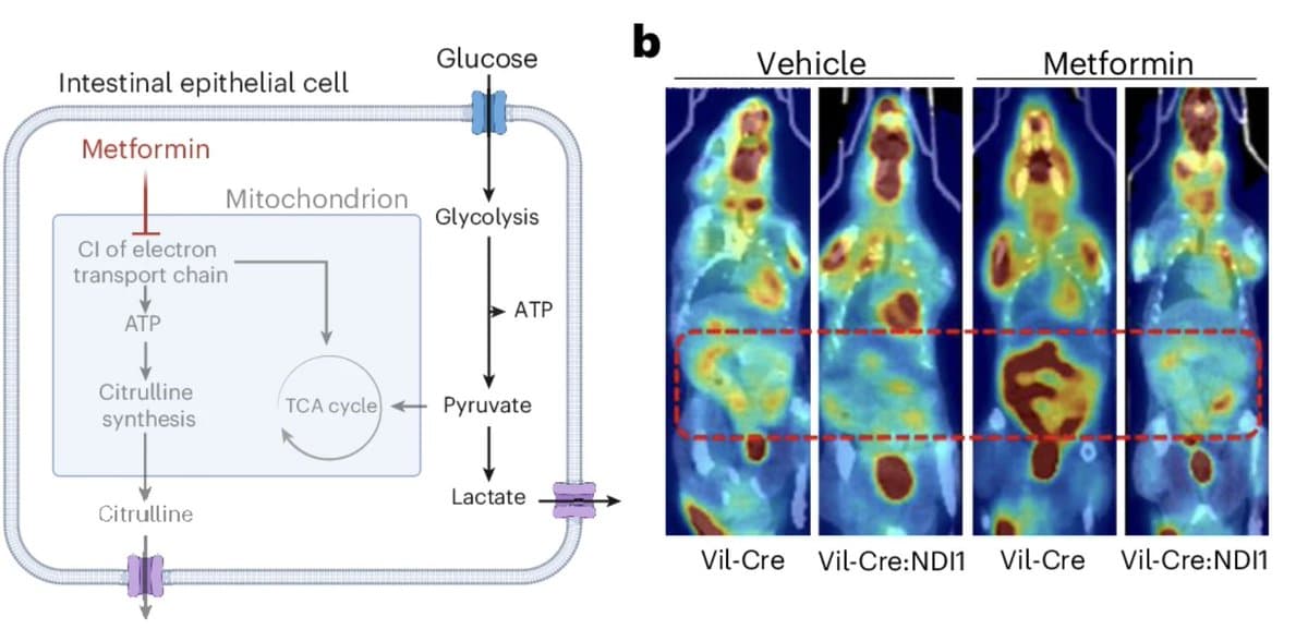 Metformin May Lower Glucose via Gut, Not Liver
