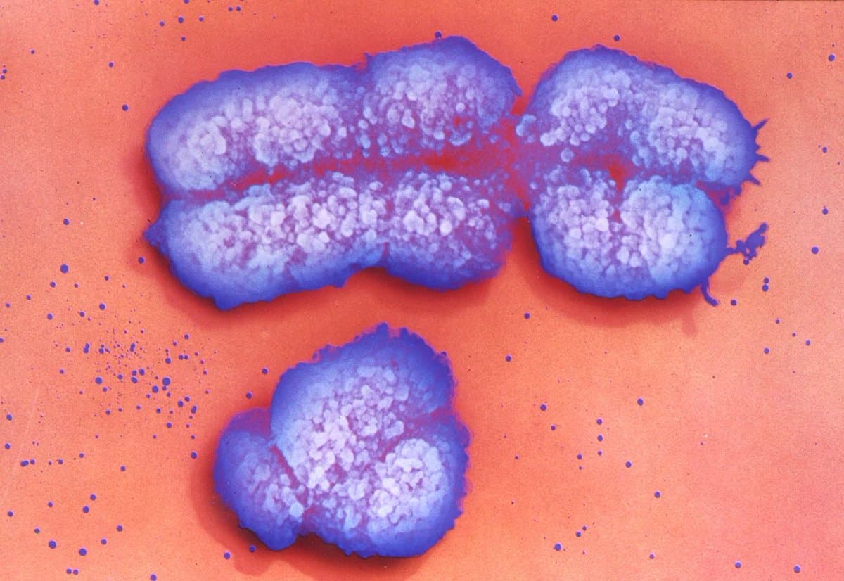 X Chromosome Plays Bigger Role in Health than Thought