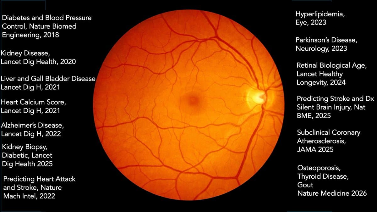 Retina Scans Reveal Osteoporosis Risk Across the Body