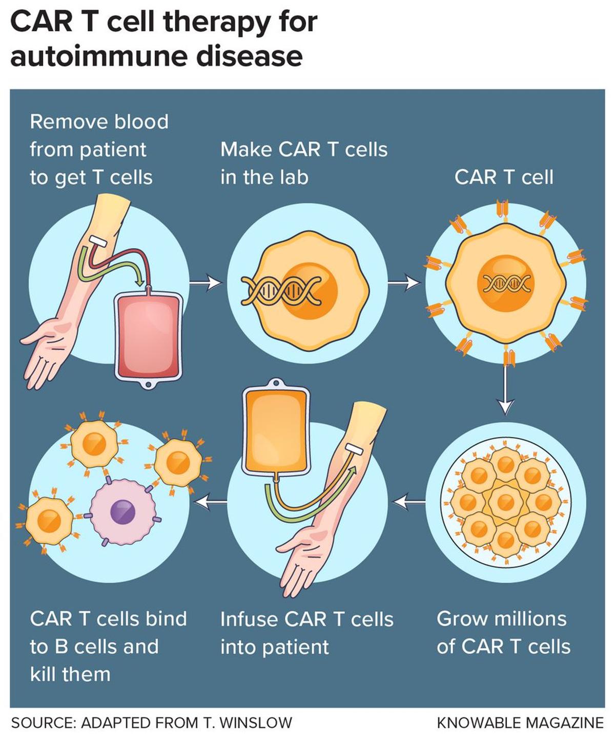 CAR‑T Therapy Shows Promise for Autoimmune Diseases
