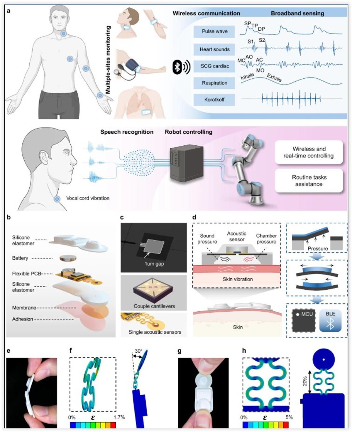 Patch‑size Stethoscope Enables Continuous Cardio‑Respiratory Monitoring