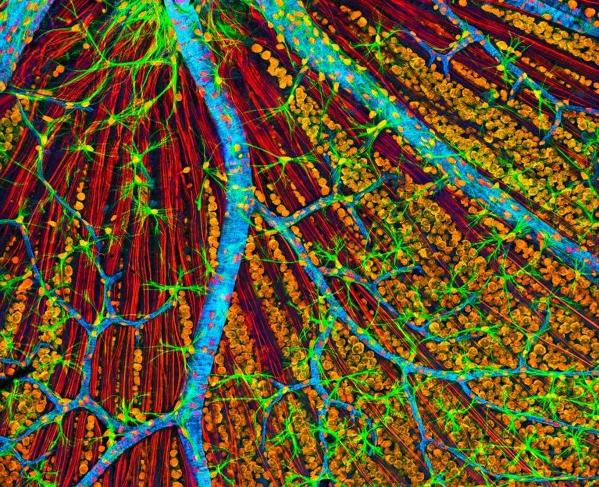 First Human Trial of Cellular-Reprogramming Eye Therapy