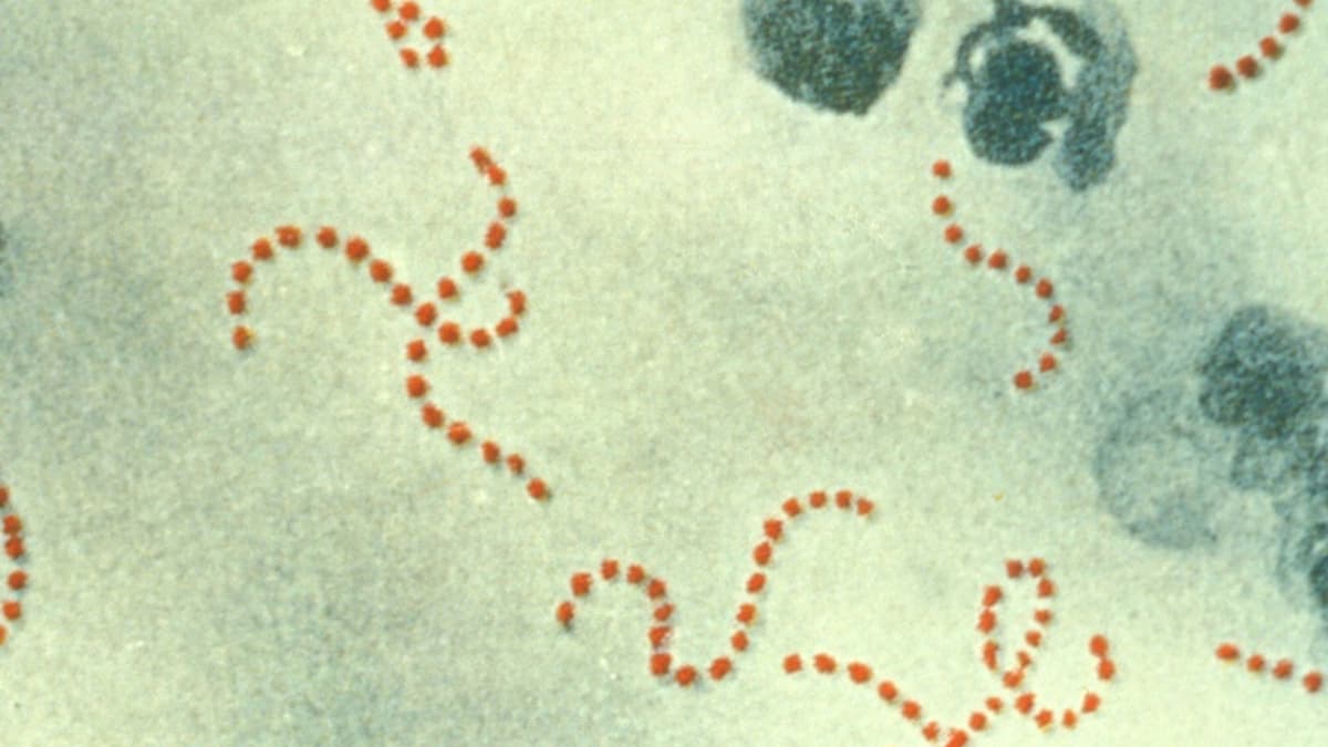 Philanthropic Drive Puts $140m Behind Strep A Vaccine