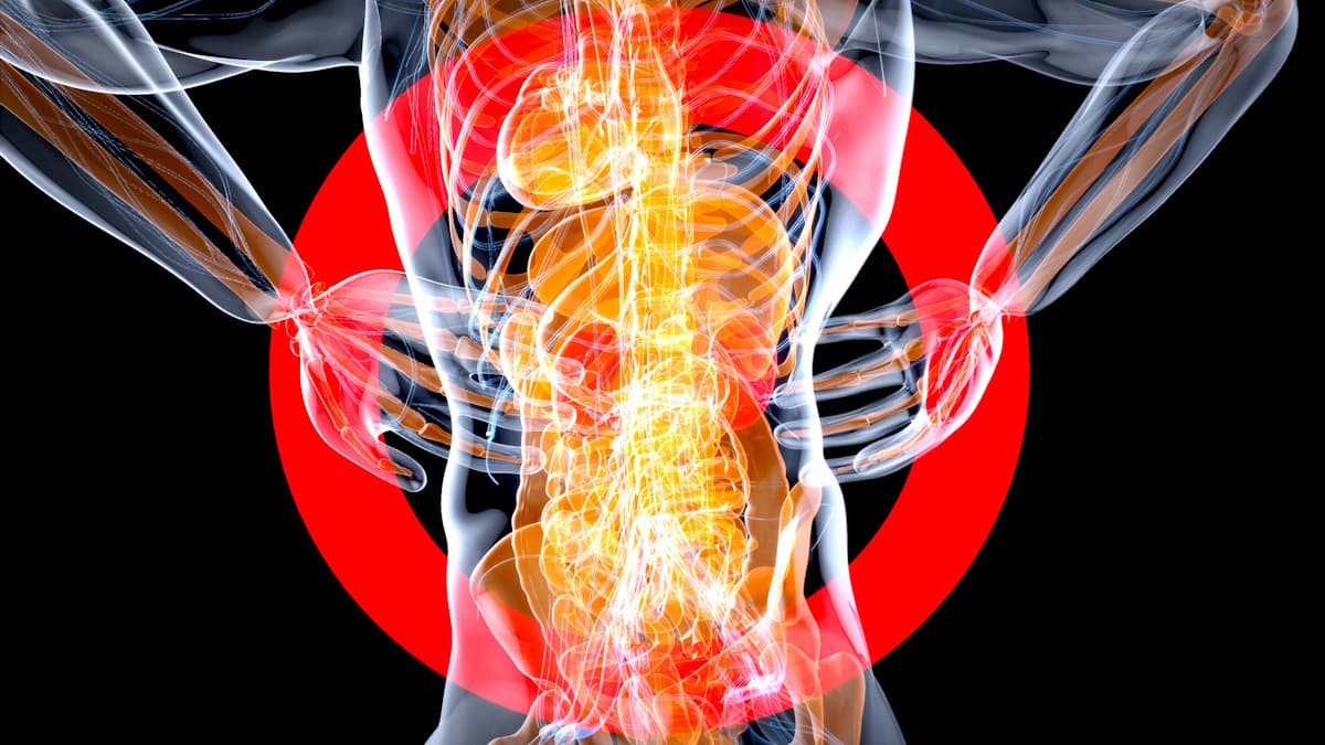 EULAR 26 Hears of Treatment Advances in Lupus