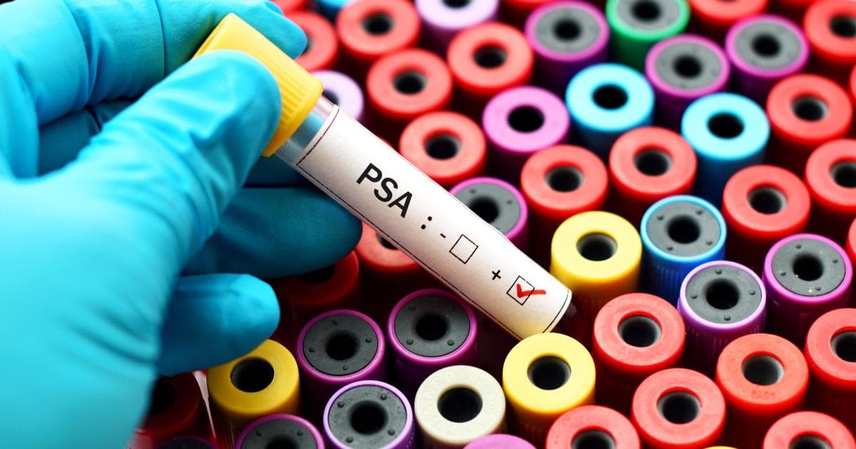 Novel Urine Test Reduces Need for MR Imaging, Prostate Biopsies