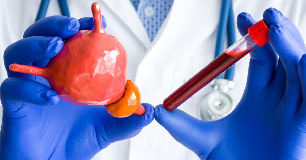 One PSMA Agent Outshines Competitors at Detecting Prostate Cancer Recurrence