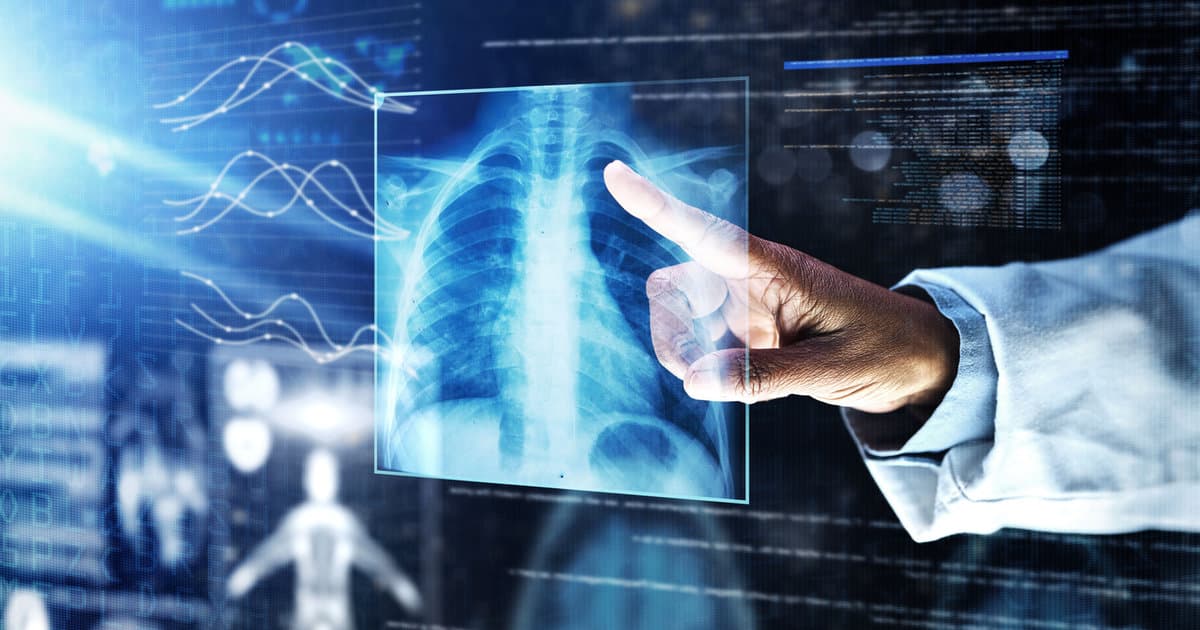 Large Language Model Helps Radiology Department Boost Patients’ Report Comprehension