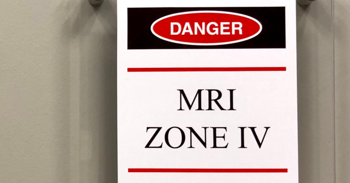 MRI Safety Guidelines May Fall Short for Patients with Implanted Electrode Cuffs