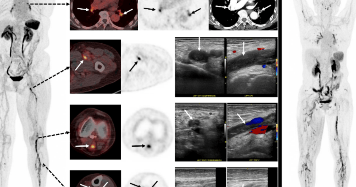 SNMMI Unveils 2026 Image of the Year