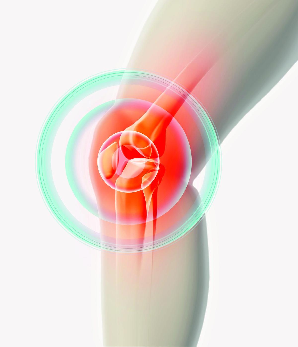 Aerobic Activity Is Best for Knee Osteoarthritis