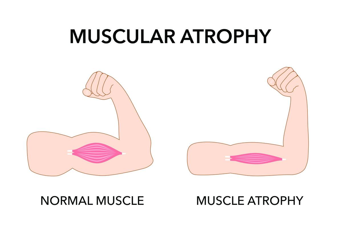 Extra Protein Does Not Preserve Muscle Size or Function with Age