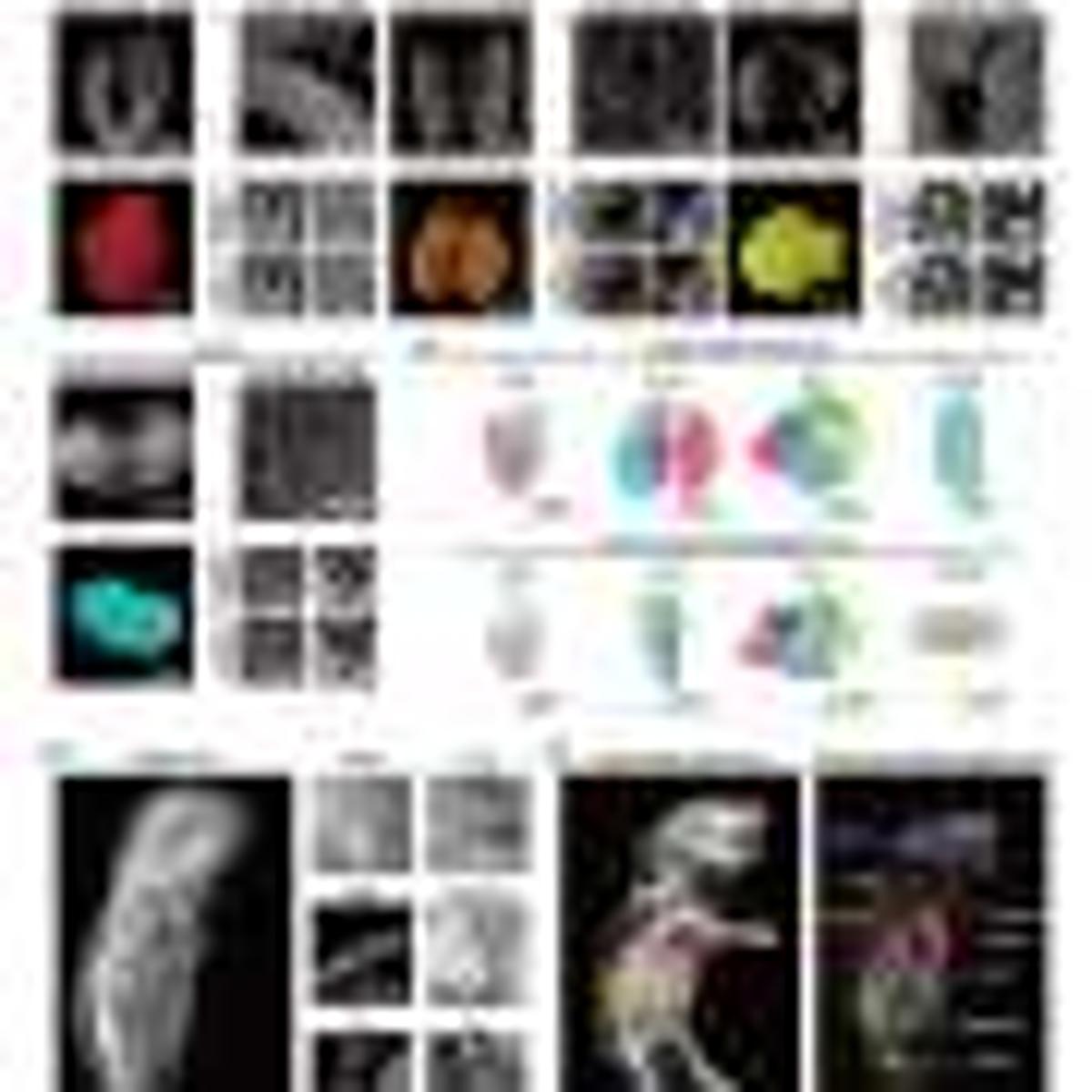 From Slices to Whole Bodies: How 3D Cell Atlases Could Reshape Pathology Research
