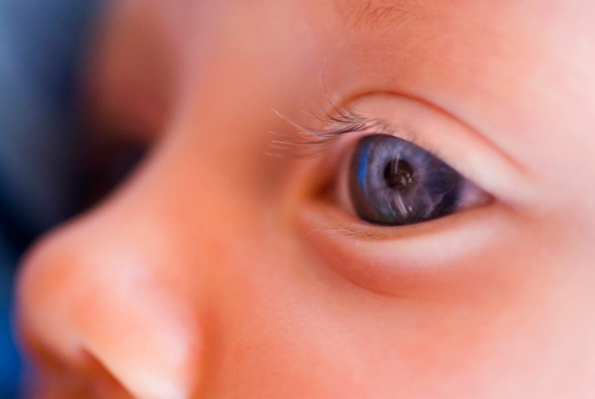 How a Vision-Restoring Gene Therapy Proved that We Can Treat Inherited Diseases
