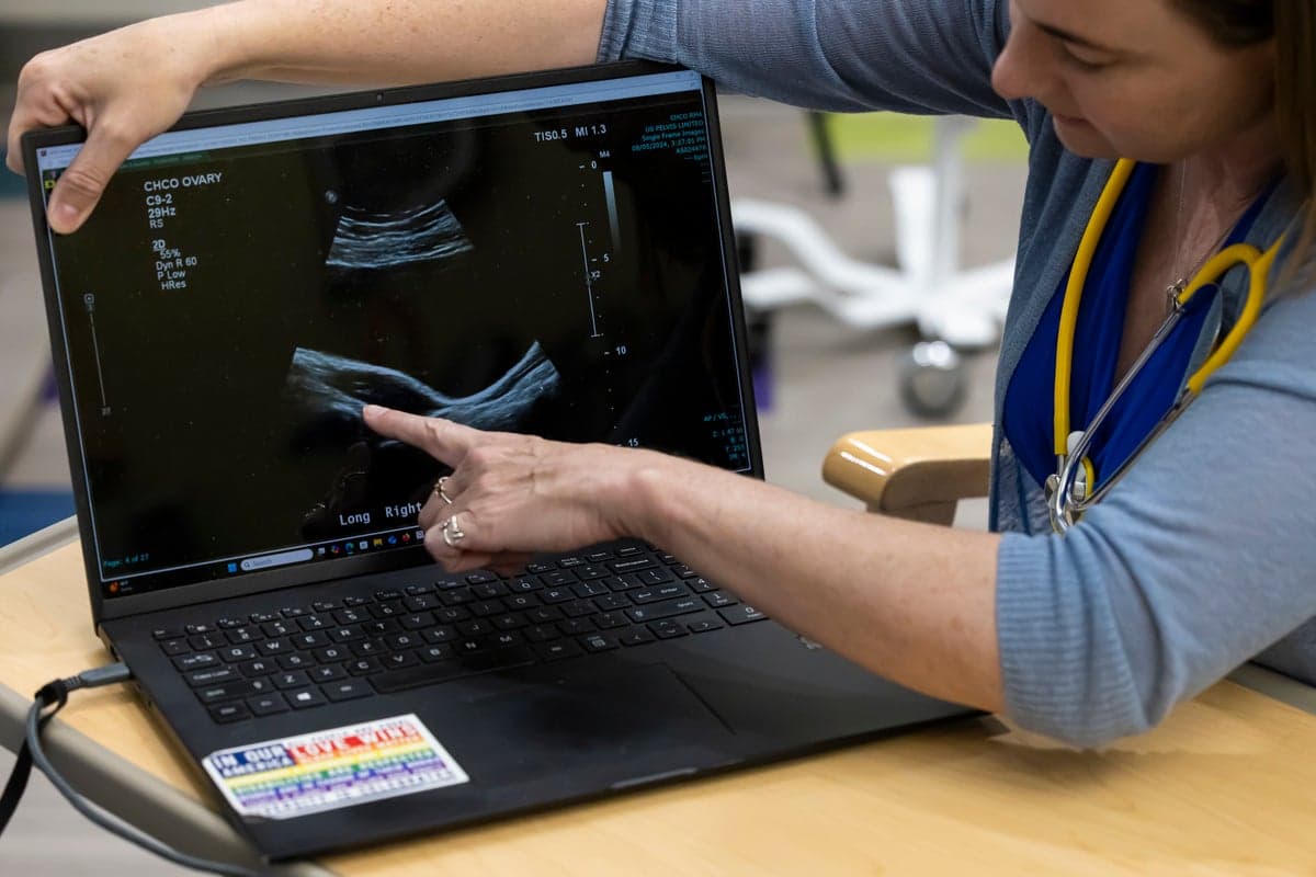 Polycystic Ovary Syndrome Might Affect Men, Too. Here’s How