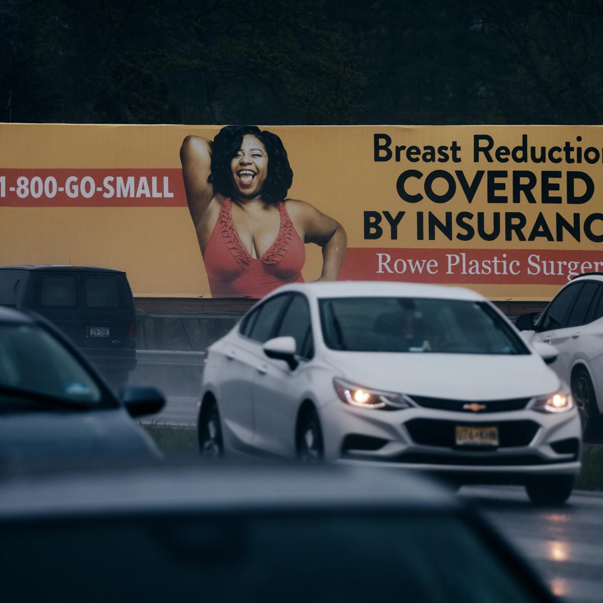 A $440,000 Breast Reduction: How Doctors Cashed In on the No Surprises Act and Arbitration