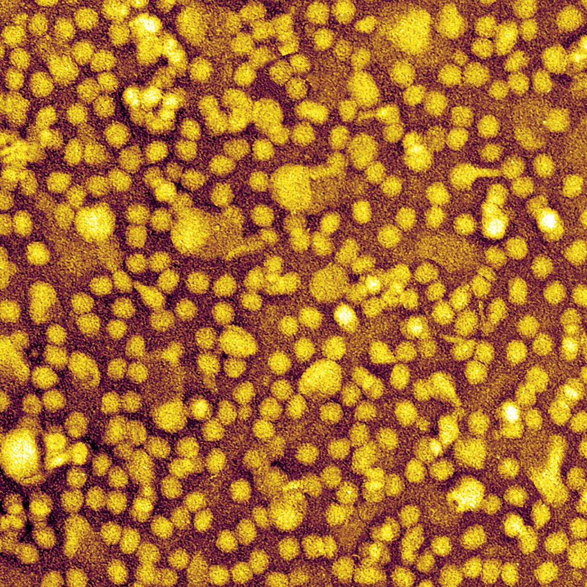One-and-Done Heart Disease Prevention? Scientists Show It May Be Possible.