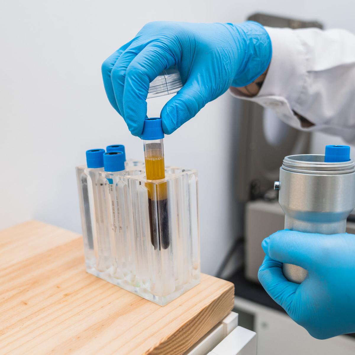 Early Research Suggests a Path to Predict and Prevent Lung Cancer