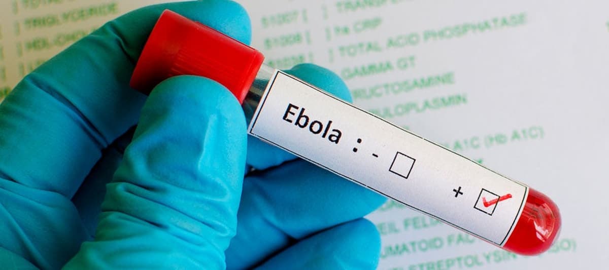 CDC Releases Advisory on Ebola Outbreak