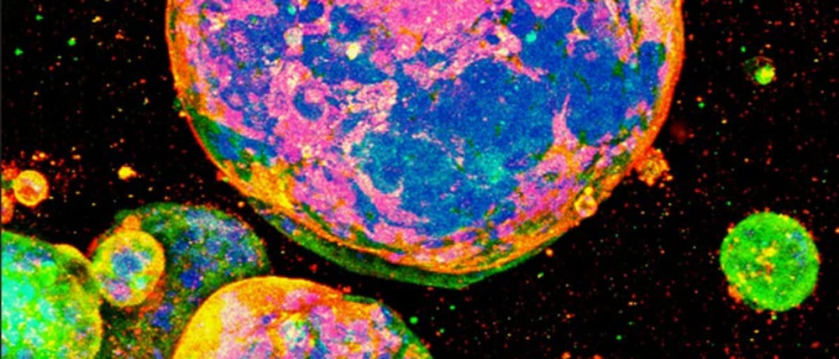 Fully Defined 3D Culture Substrate for Cancer Research