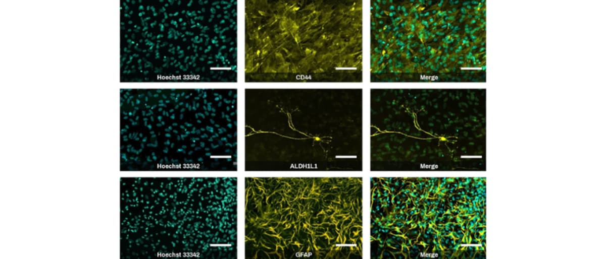 New iPSC Differentiation Kits for Neuroscience Research