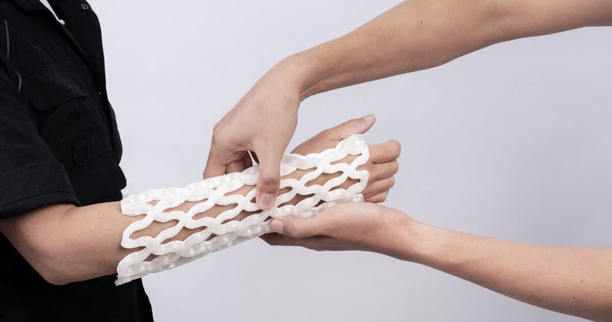 Castomize Rethinks the Orthopedic Cast as a Breathable ‘4D-Printed’ Lattice Shell