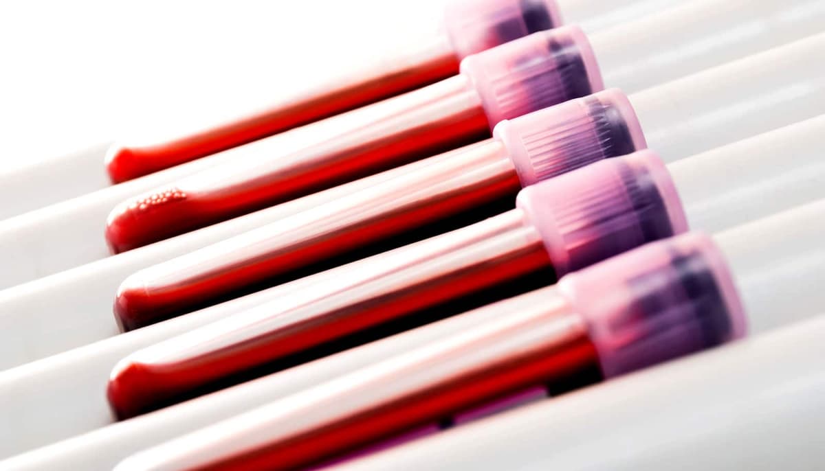 Team Finds Markers of Inflammatory Breast Cancer in Blood