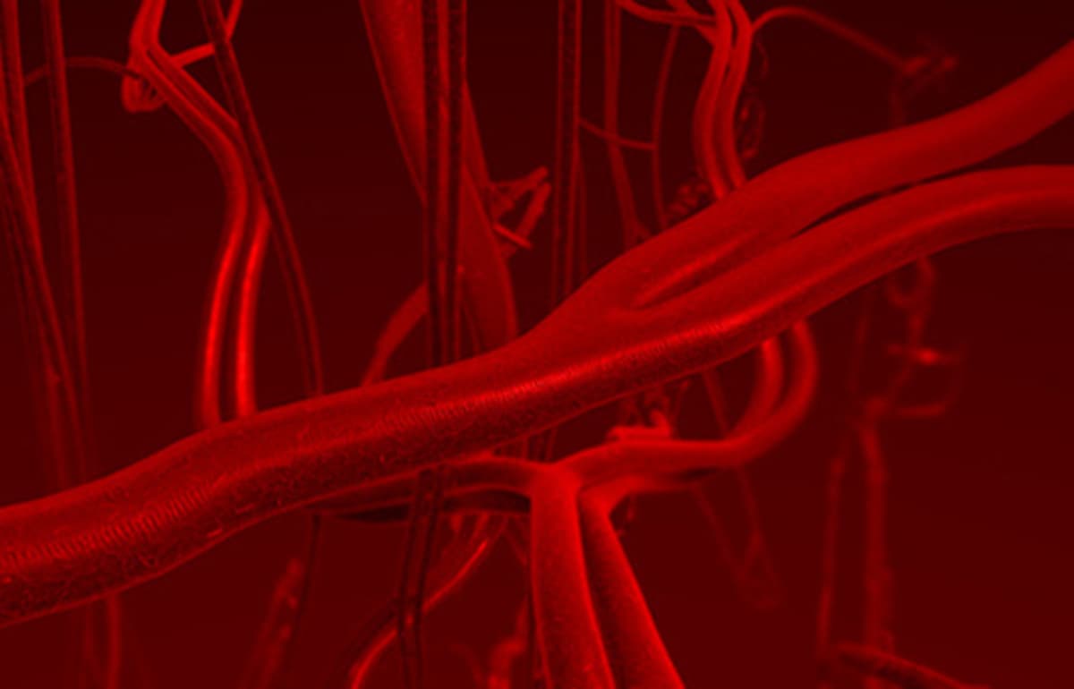 Cellular Mechanisms Behind Diabetes-Derived Vascular Disease Unveiled