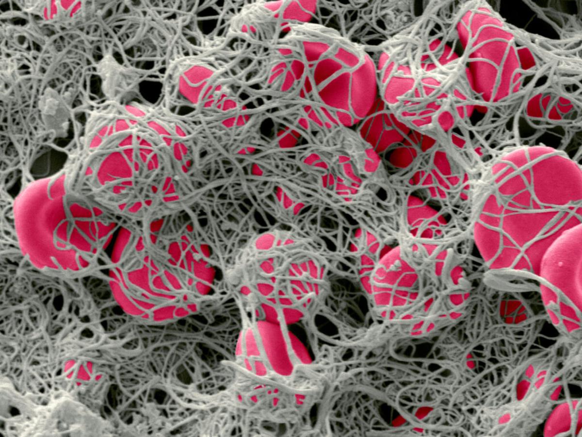 “Click Clotting” Technique Rapidly Creates Stronger Blood Clots