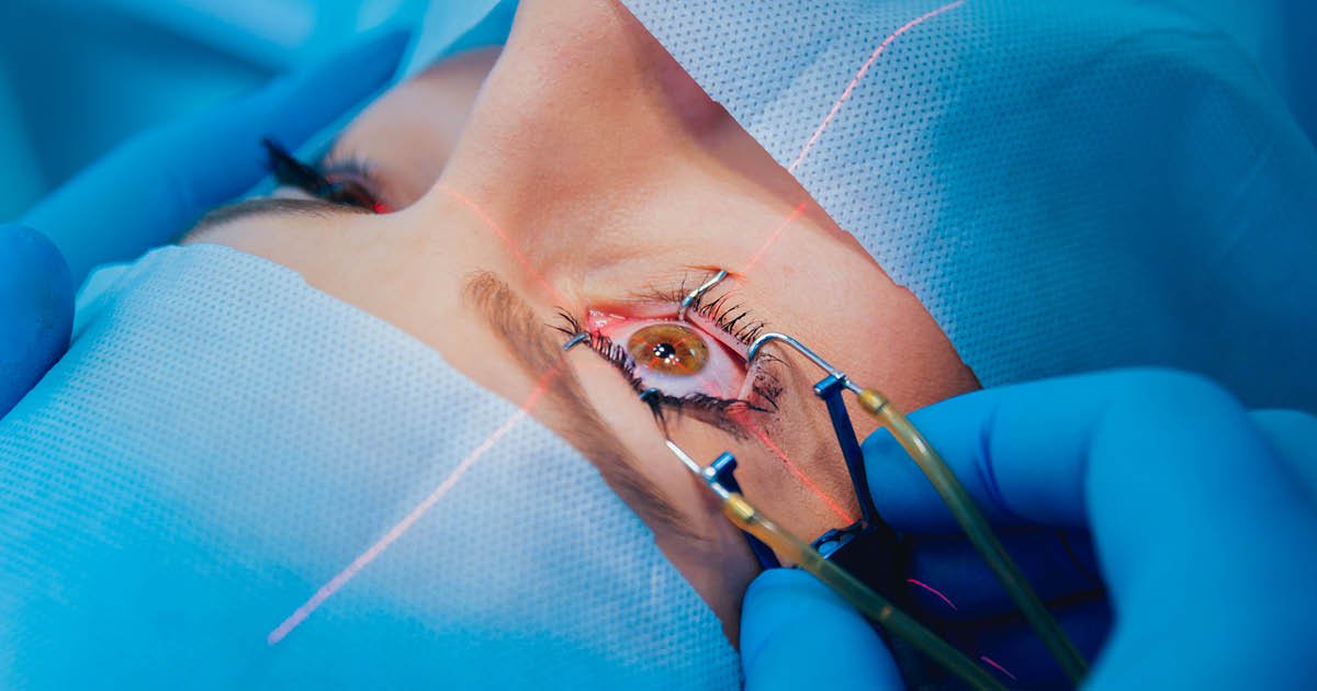 Screen for Asymptomatic MGD Before Refractive Surgery