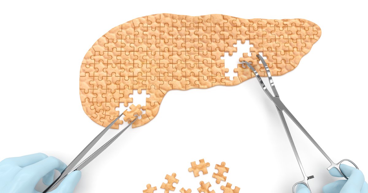Olezarsen Reduces Triglycerides, Acute Pancreatitis Events