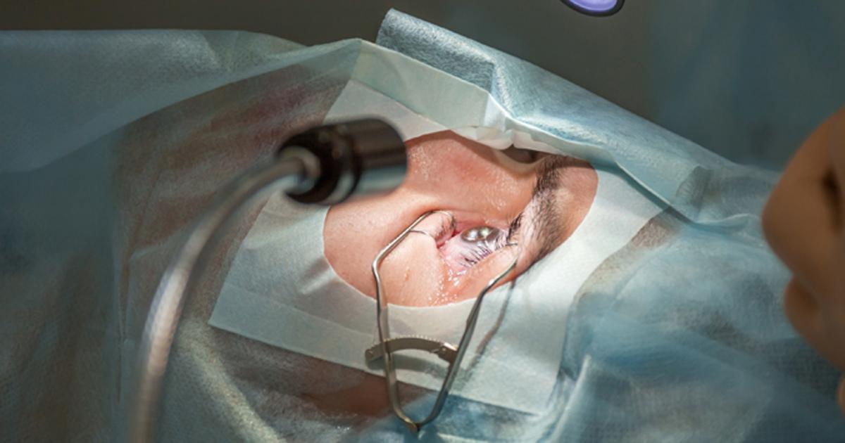 Uveitis Attack History May Predict Cataract Surgery Outcomes