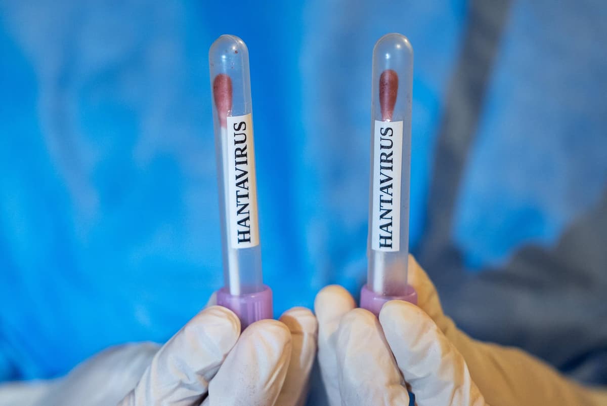 COVID Response Coordinator Shares Why the Hantavirus Won’t Turn Into Another Pandemic