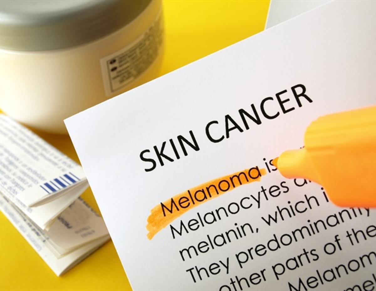 AAD Survey Reveals Americans Ignore Sun Risks Despite Skin Cancer Concerns