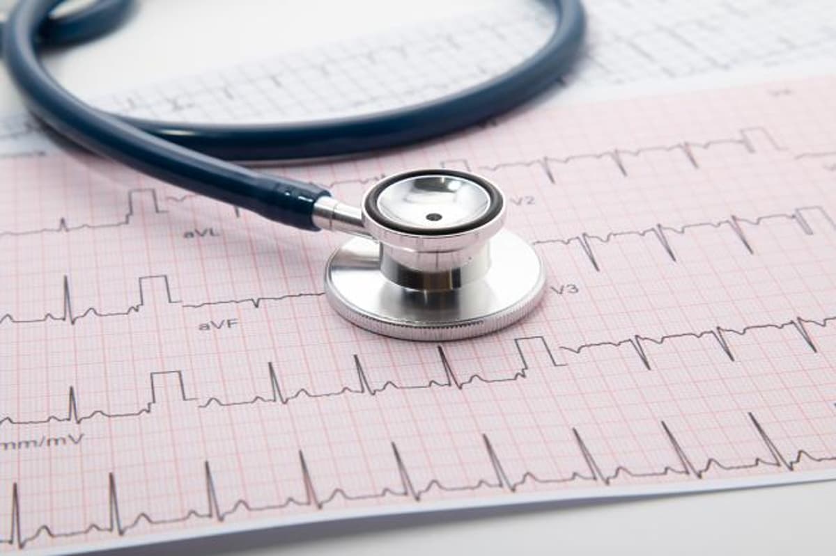 Researchers Develop Innovative Model for Risk Assessment for Hypertrophic Cardiomyopathy
