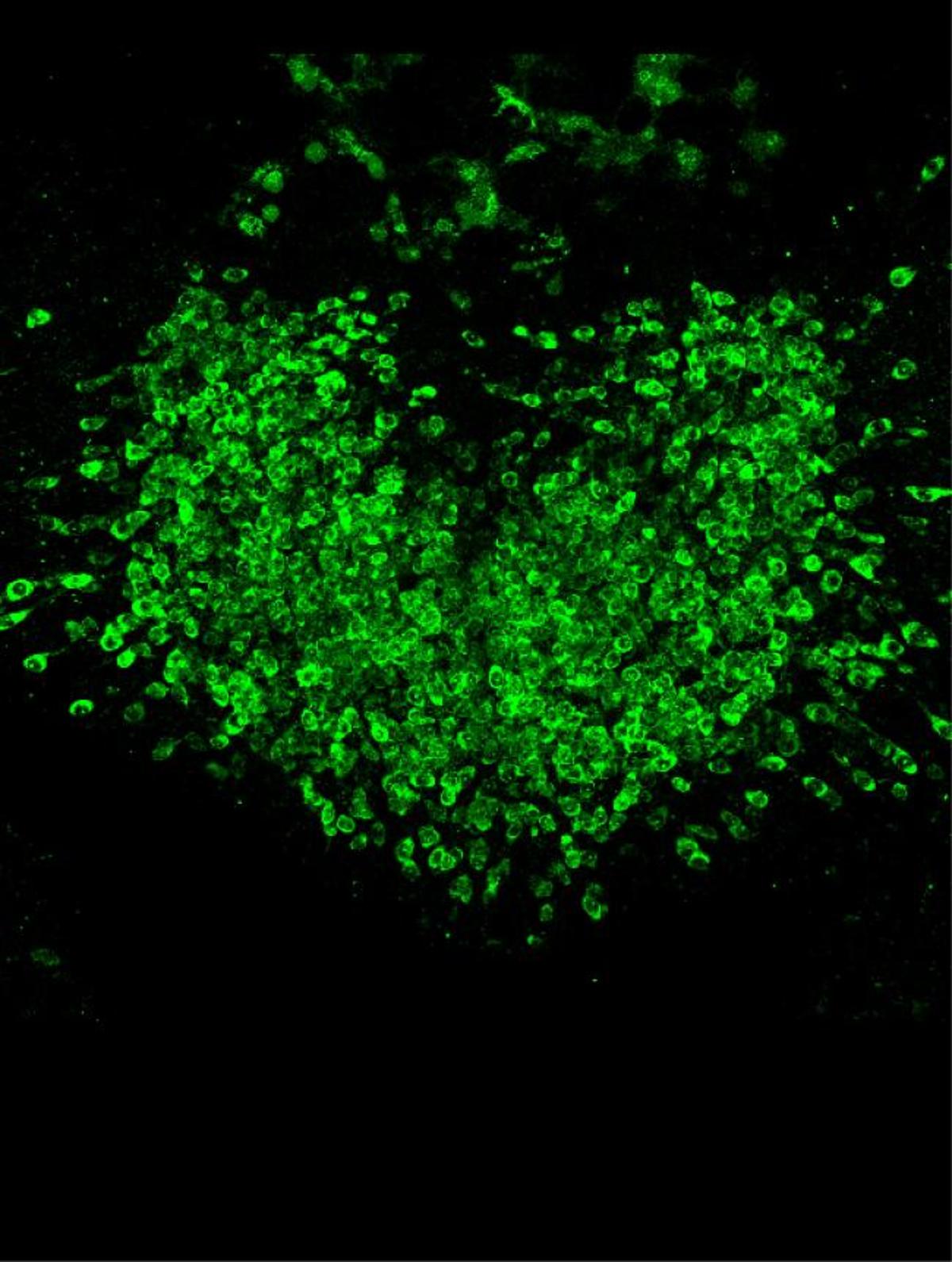 NIH Researchers Identify Avenue for Enhanced GLP-1-Induced Weight Loss