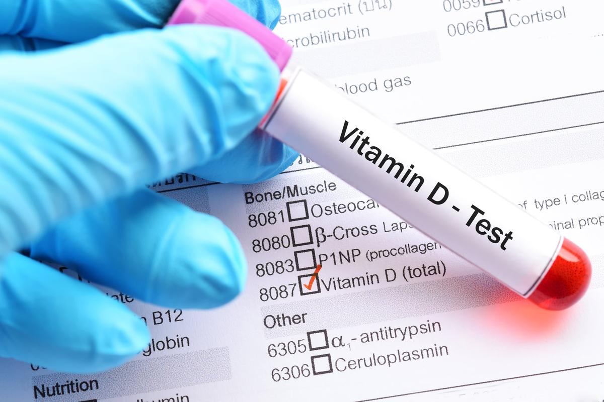 Daily Vitamin D Chocolate Wafer Achieves Sufficiency in Three Months, Study Suggests