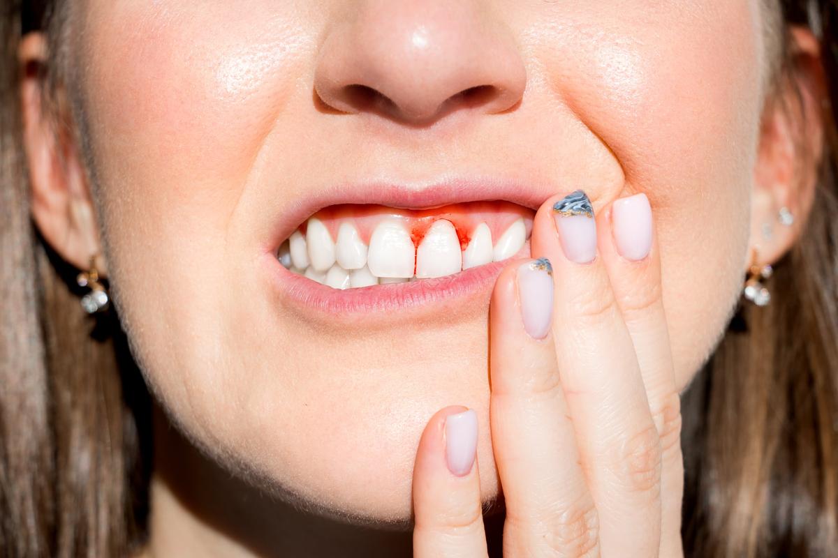 Postbiotics Use Reduces Gingival Inflammation - Japan Study
