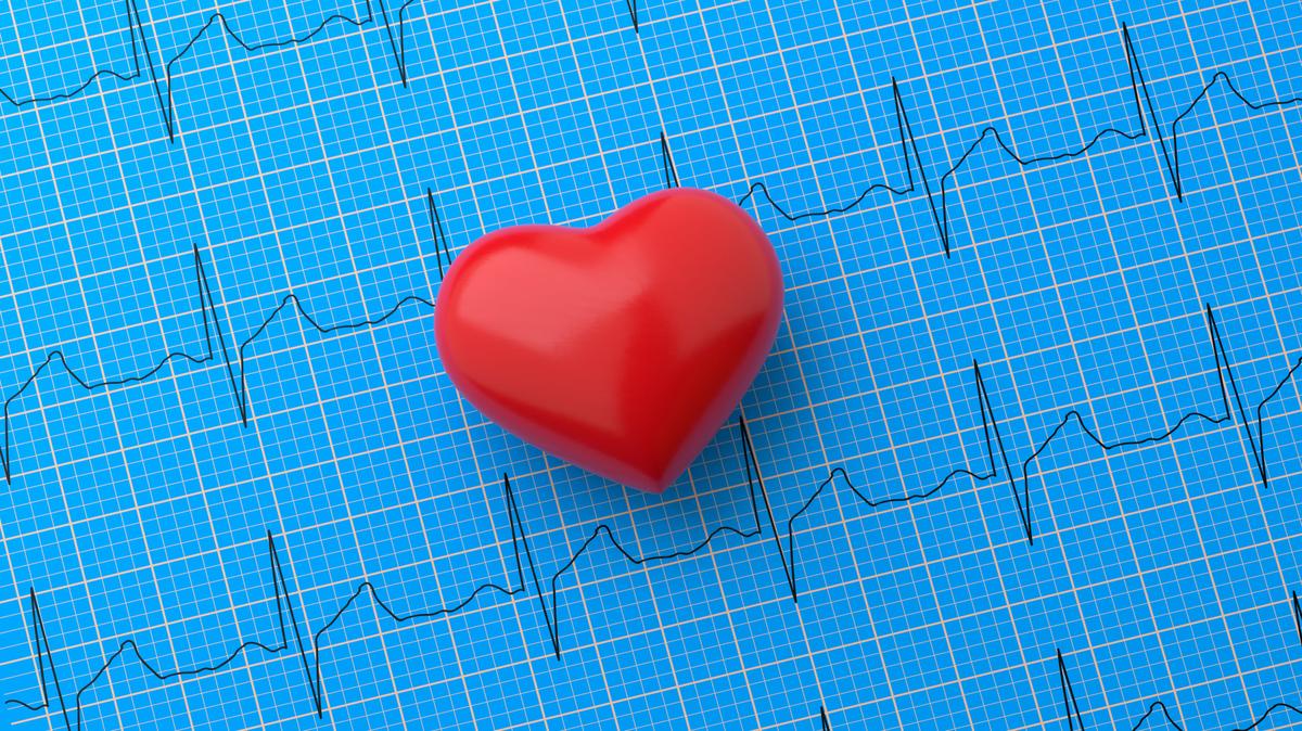 Vitamin K2-7 May Slow Progression of Coronary Artery Calcification