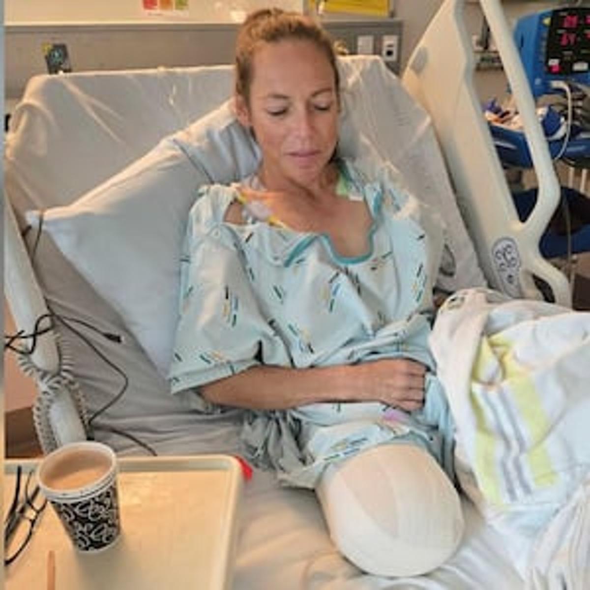 Central Hawke’s Bay Mum Has Leg Removed in Fight Against Clear Cell Sarcoma Pain