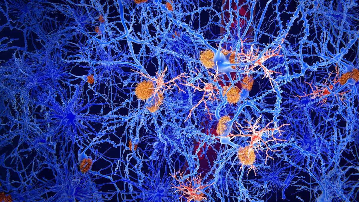 Scientists Reprogram Brain Immune Cells to Fight Alzheimer’s
