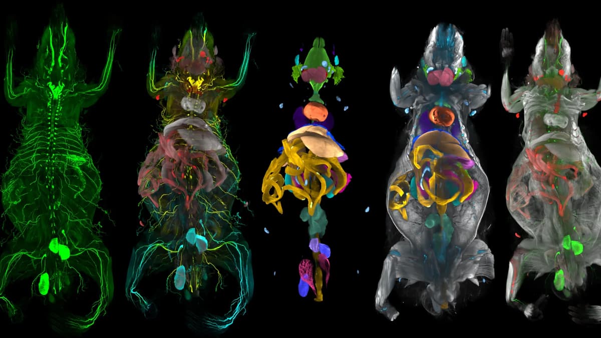 New AI Body Map Reveals Obesity’s Hidden Attack on Facial Nerves