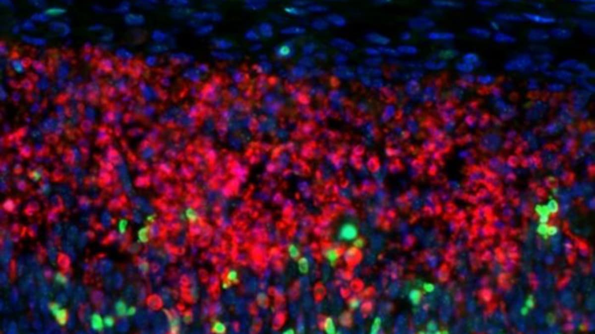 Why some Brain Cells Are Particularly Vulnerable to Multiple Sclerosis