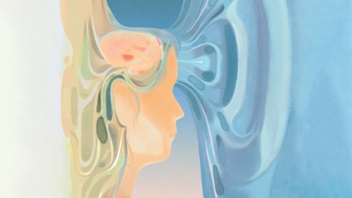 Ultrasound Aimed at the Brain Offers New Hope for Parkinson’s Patients